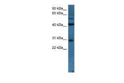 TLX2 Rabbit anti-Human, Polyclonal, Novus Biologicals 0.1ml; Unconjugated:Antibodies,